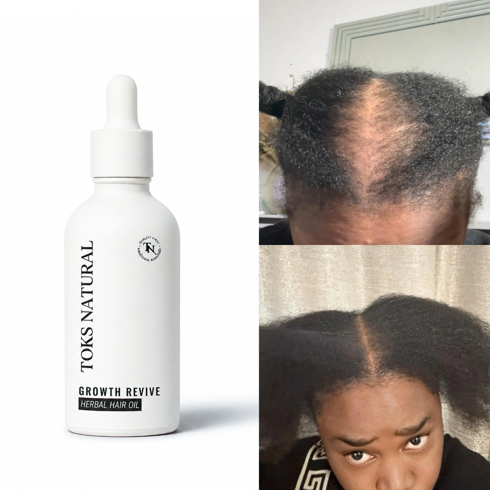 Growth Revive™ Herbal Hair Oil - Image 2