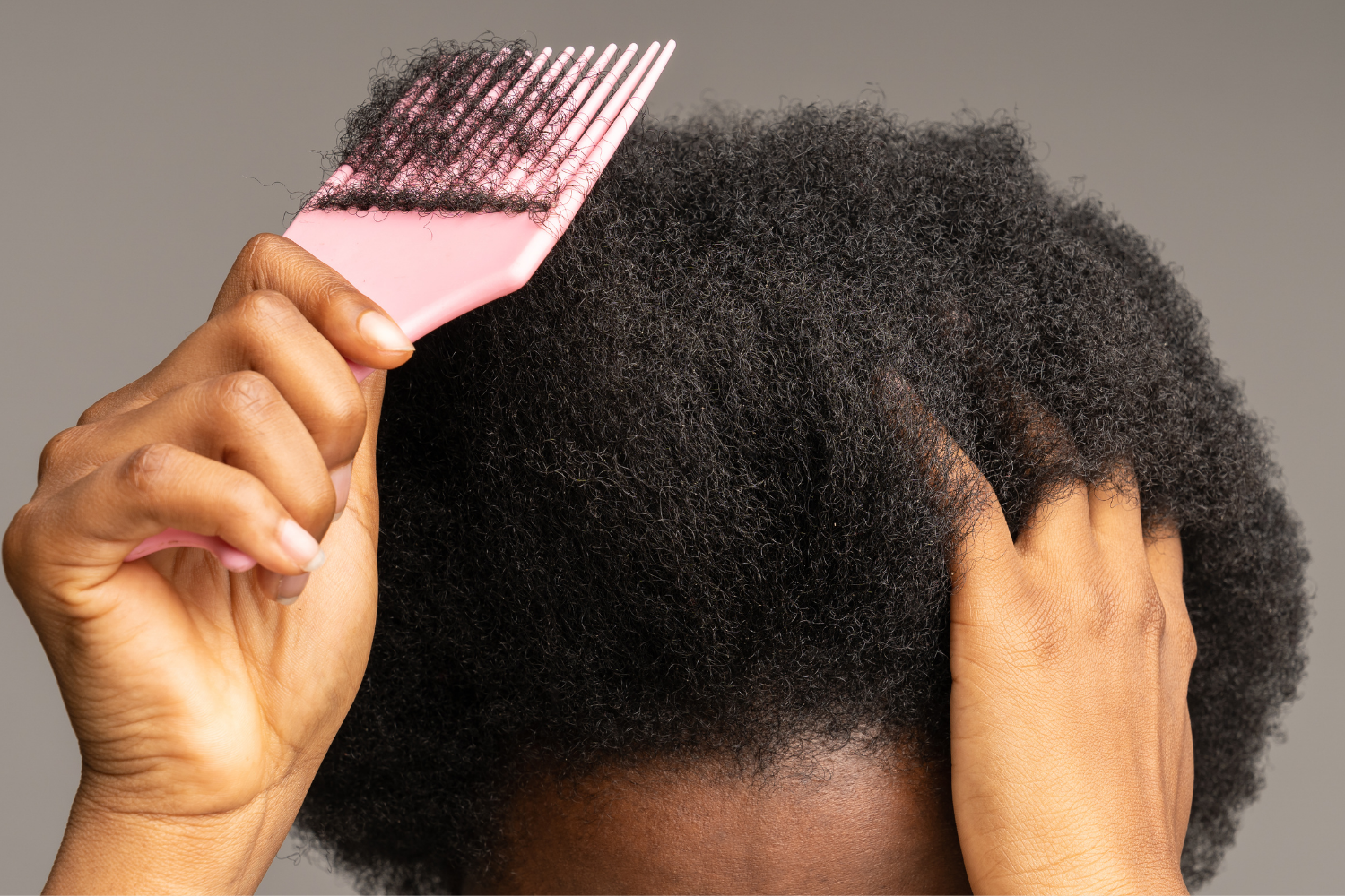 Why Isn’t My Hair Growing? The Real Reason Behind African Women’s Struggle With Length