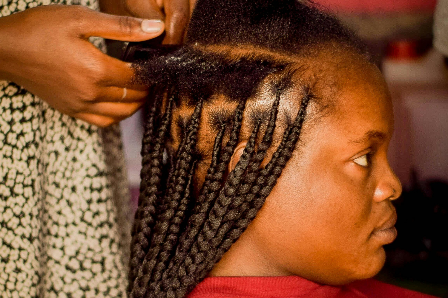 Signs Your Braids or Wig Are Damaging Your Edges (And How to Fix It)
